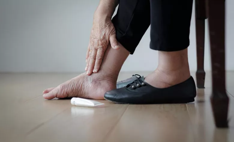 How to Prevent Swollen Ankles After Flying